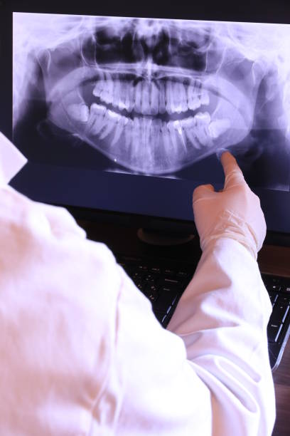 Best Emergency Tooth Extraction in Bono, AR