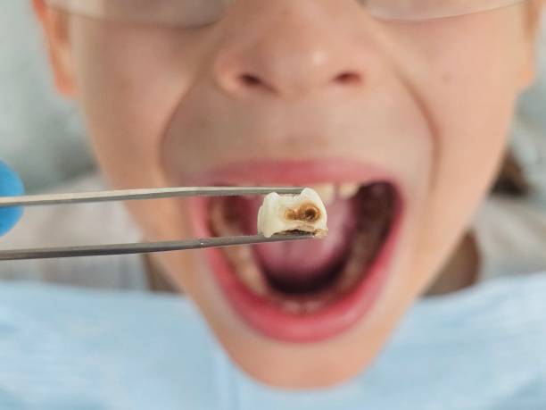 Best Urgent Care for Lost Fillings or Crowns in Bono, AR